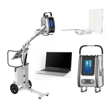 SONTU60 5kw/8kw דיגיטלי נייד מכונת רנטגן אלחוטי 14*17 FPD